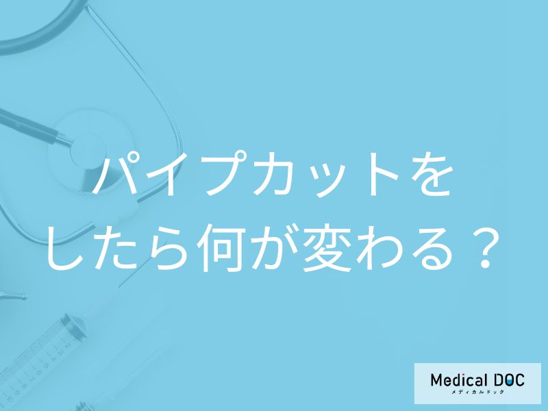パイプカットで精力・男性ホルモンは変わらない? 避妊が不要になるまでの期間と手術費用の目安【医師解説】