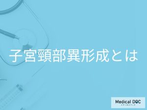 子宮頸がんは聞いたことあるけど… 子宮頸部異形成って何？