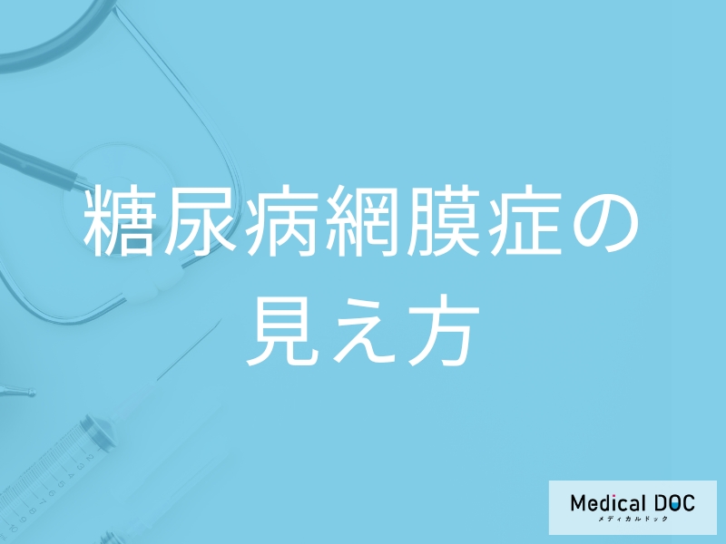 「糖尿病網膜症」を発症するとどんな見え方になるかご存知ですか？【医師監修】