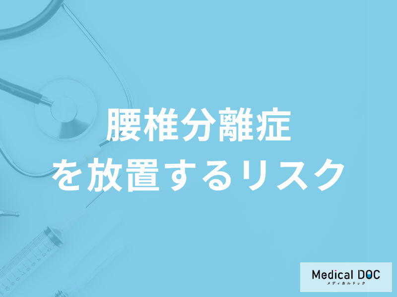 「腰椎分離症を放置する」とどんな「リスク」が発生するのか？注意点も医師が解説！