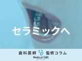 数年前に入れた差し歯・銀歯を「セラミック」に変えるには何に気を付けたらいい？【歯科医解説】