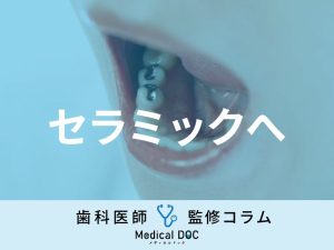 数年前に入れた差し歯・銀歯をセラミックに変るには何に気を付けたらいい？【歯科医解説】