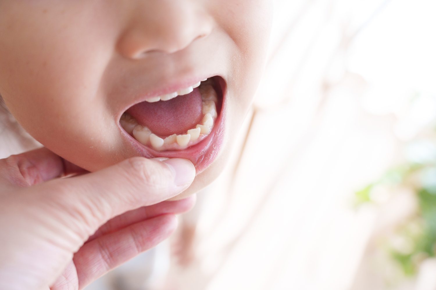 子どもの歯列矯正は必要？メリットやデメリット、治療の流れも解説！