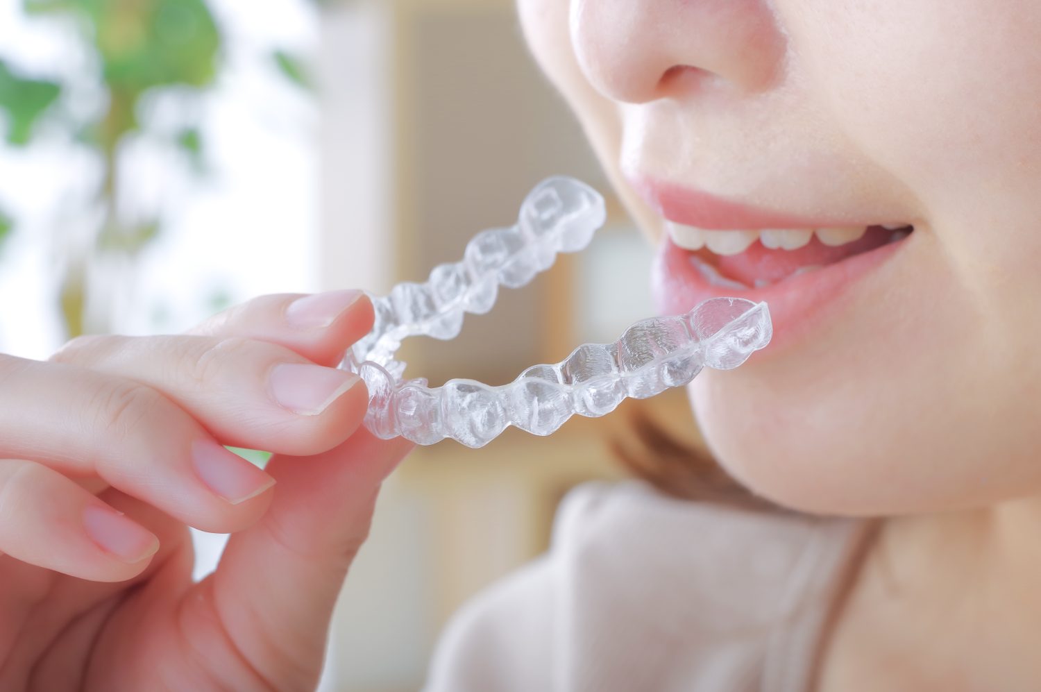 インビザラインの治療は何年かかる？治療期間が長引く原因や短縮のポイントとは