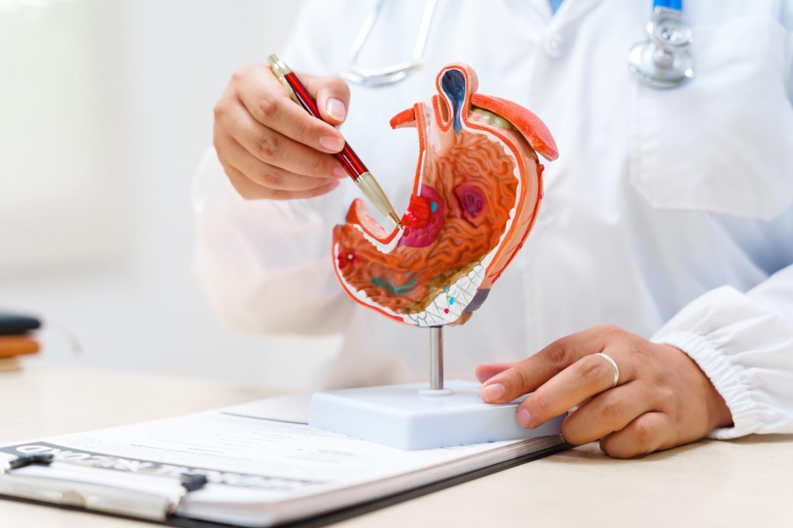 胃潰瘍が起こる仕組み