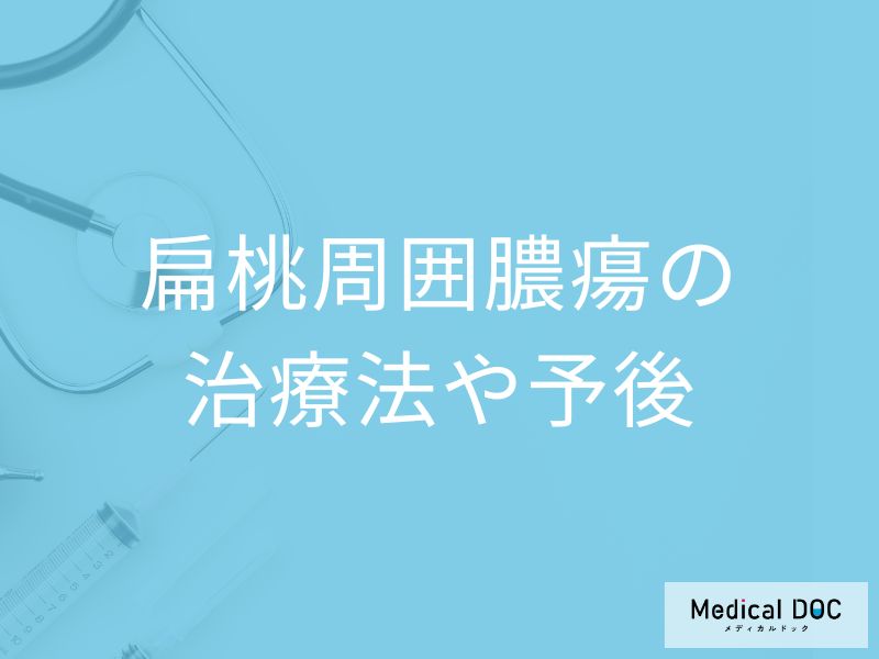 「扁桃周囲膿瘍」が治るのにはどのくらいかかる？治療法・予防法を医師が解説！