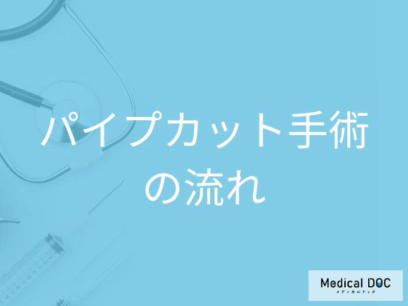 パイプカット手術の具体的な流れ! 手術の流れ、麻酔、術後の注意点を医師が解説
