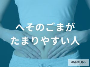 へそのごまがたまりやすい方の特徴