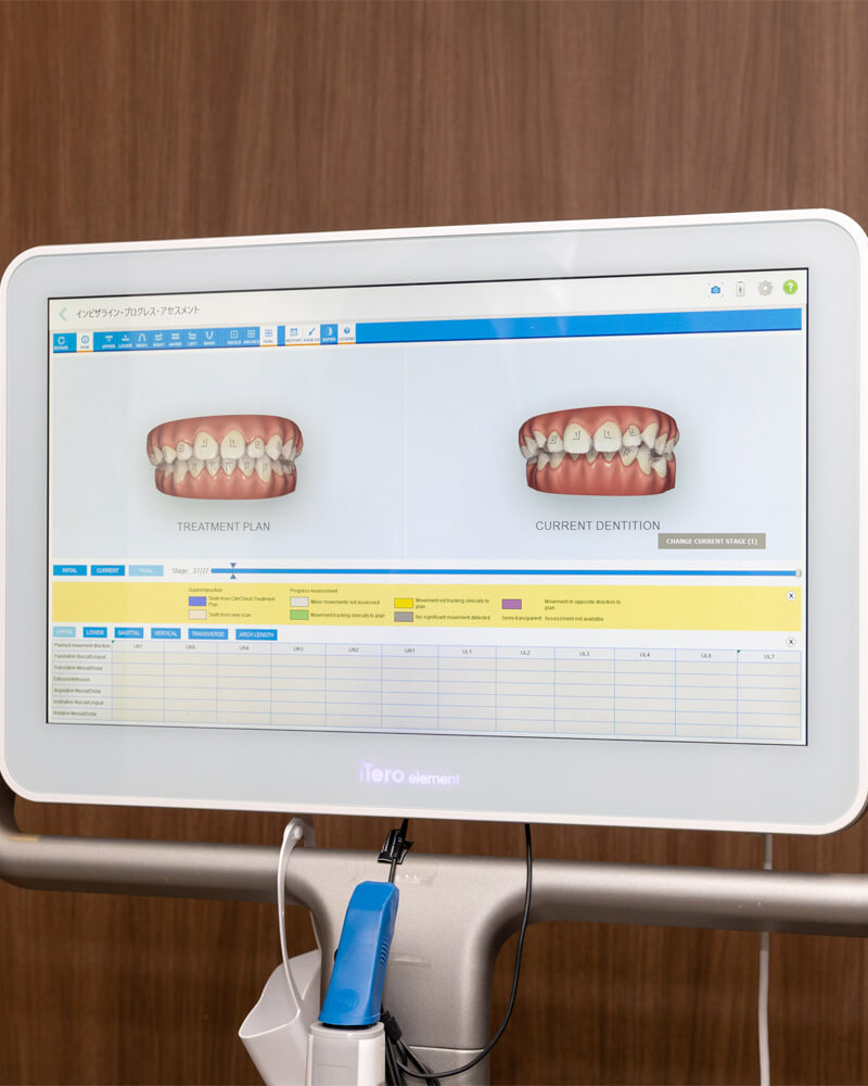 子どもの歯を守るため、親がやっておきたい日頃のケア