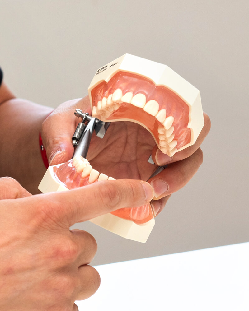 審美のための矯正治療と、自分の歯を守るための矯正治療