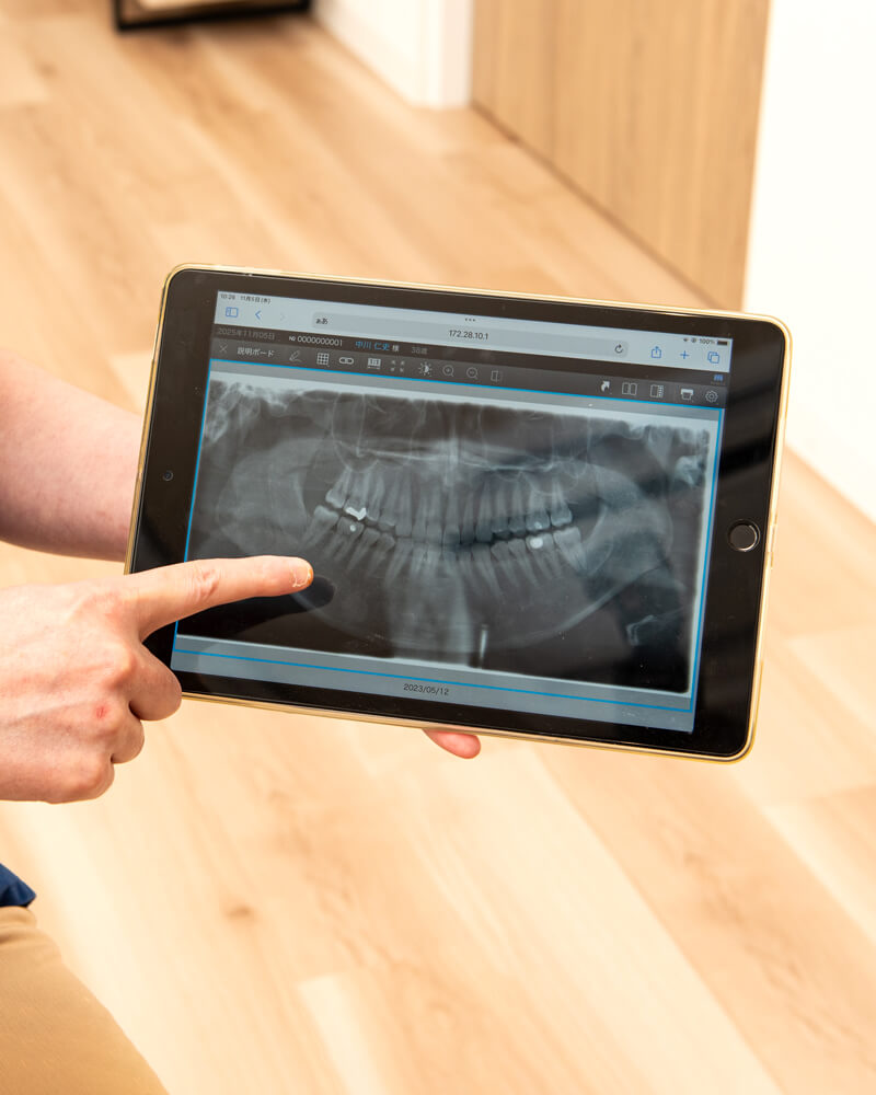 “怒らない歯医者さん”の予防メニュー。診療の流れと痛みへの配慮