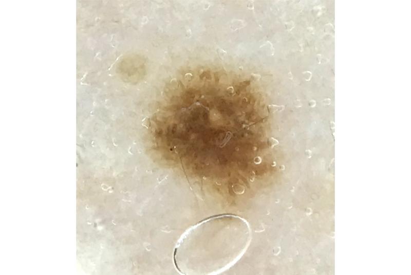 ヴェリィ形成皮フ科クリニック