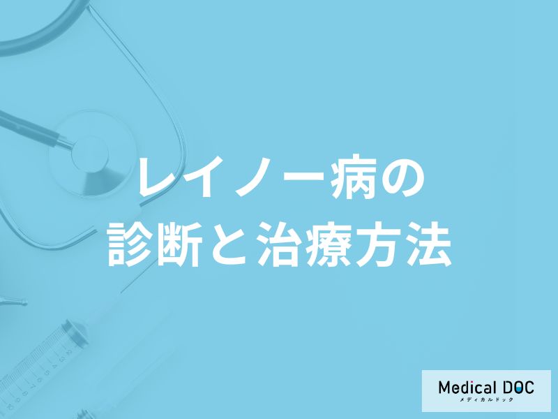 「レイノー病」は何科を受診すればいいの？治療法や対処法も解説！【医師監修】