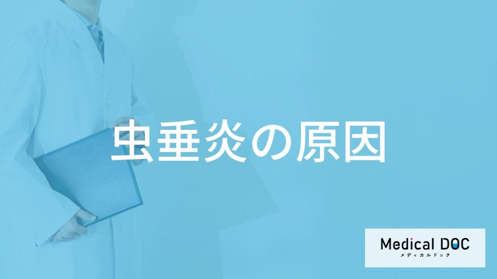 「虫垂炎の原因」はご存知ですか？なりやすい人の特徴も解説！【医師監修】
