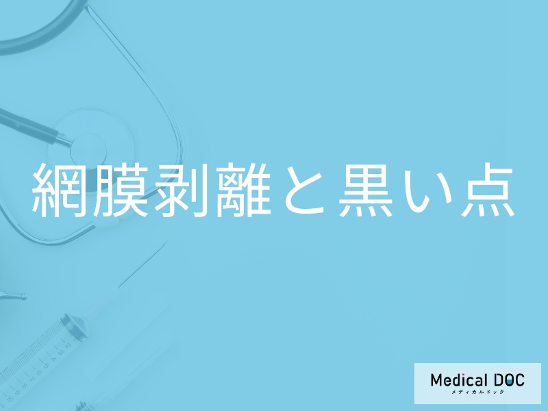 「目に黒い点」が見えたら「網膜剥離」を疑った方がいいの？【医師監修】
