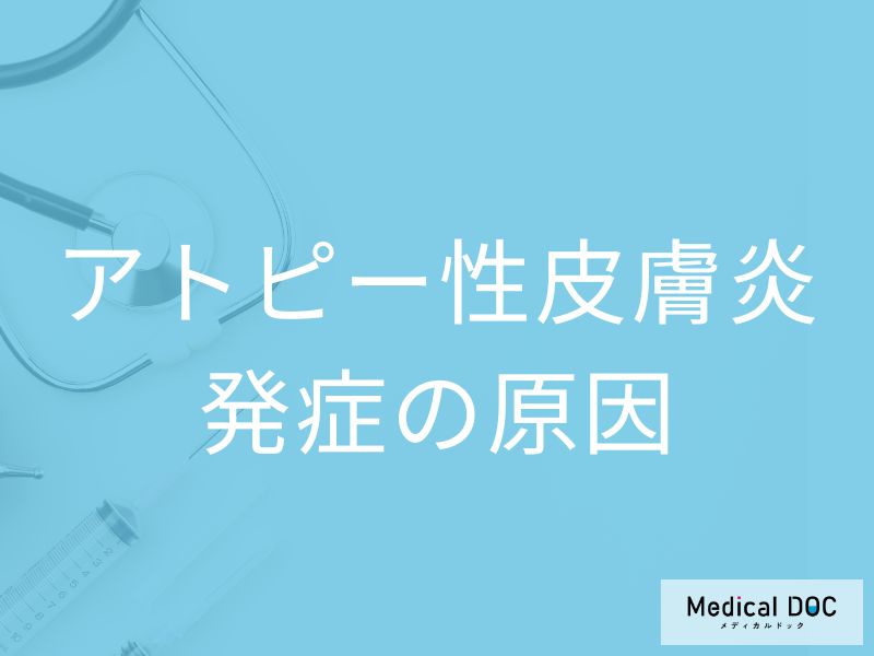 アトピー性皮膚炎はなぜ発症する? 主な3つの原因と皮膚のバリア機能の異常【医師解説】