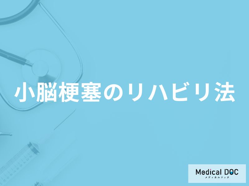 「小脳梗塞のリハビリ法」はご存知ですか？医師が徹底解説！