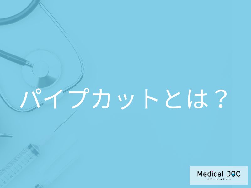 パイプカットとは？