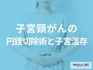 円錐切除術と子宮温存の可能性