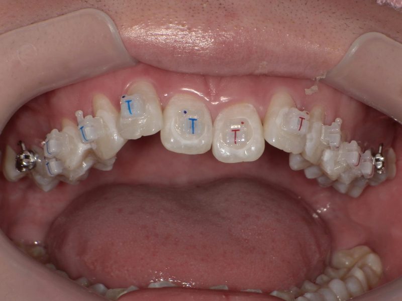 こじま矯正歯科クリニック