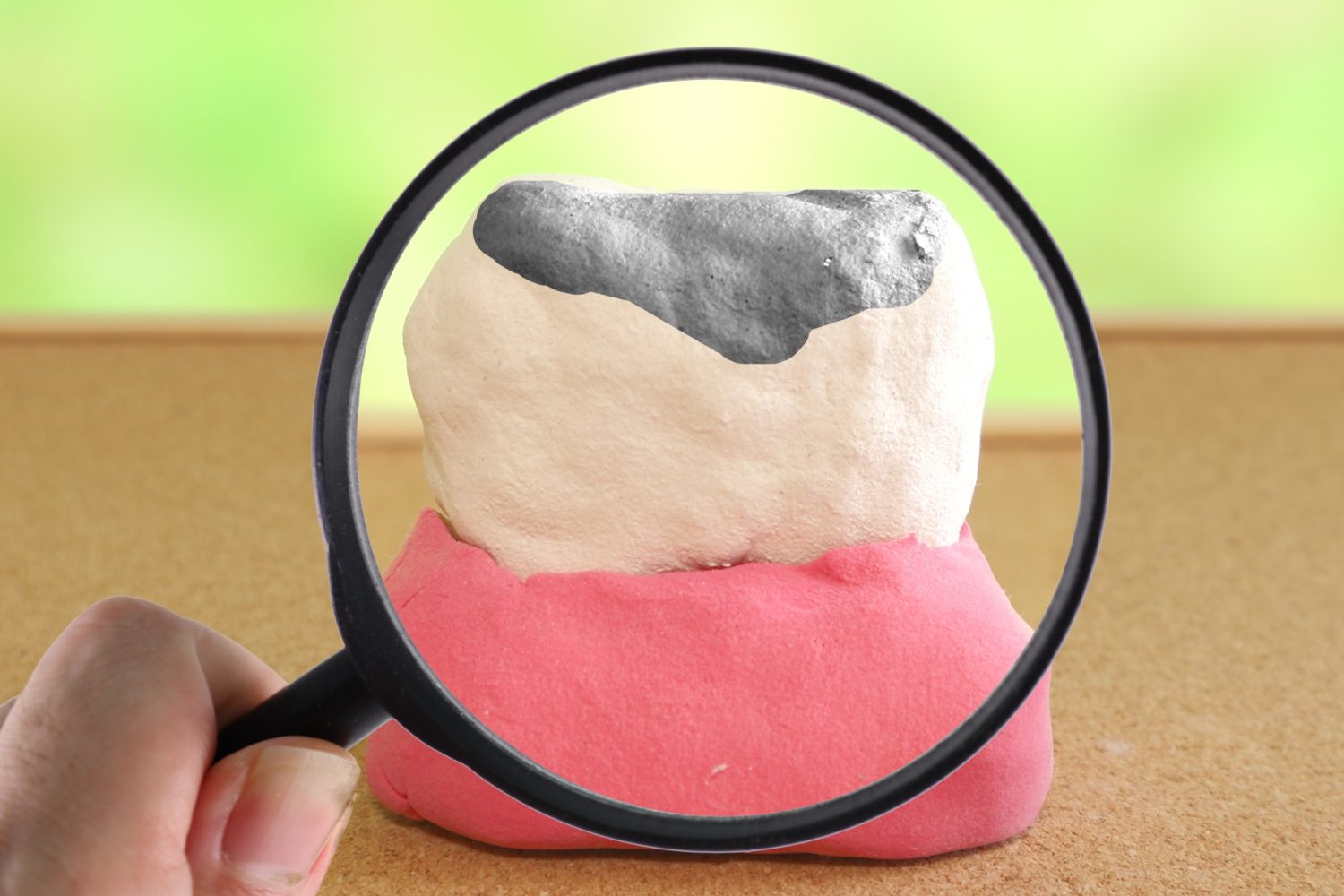 むし歯リスクが高い人の特徴