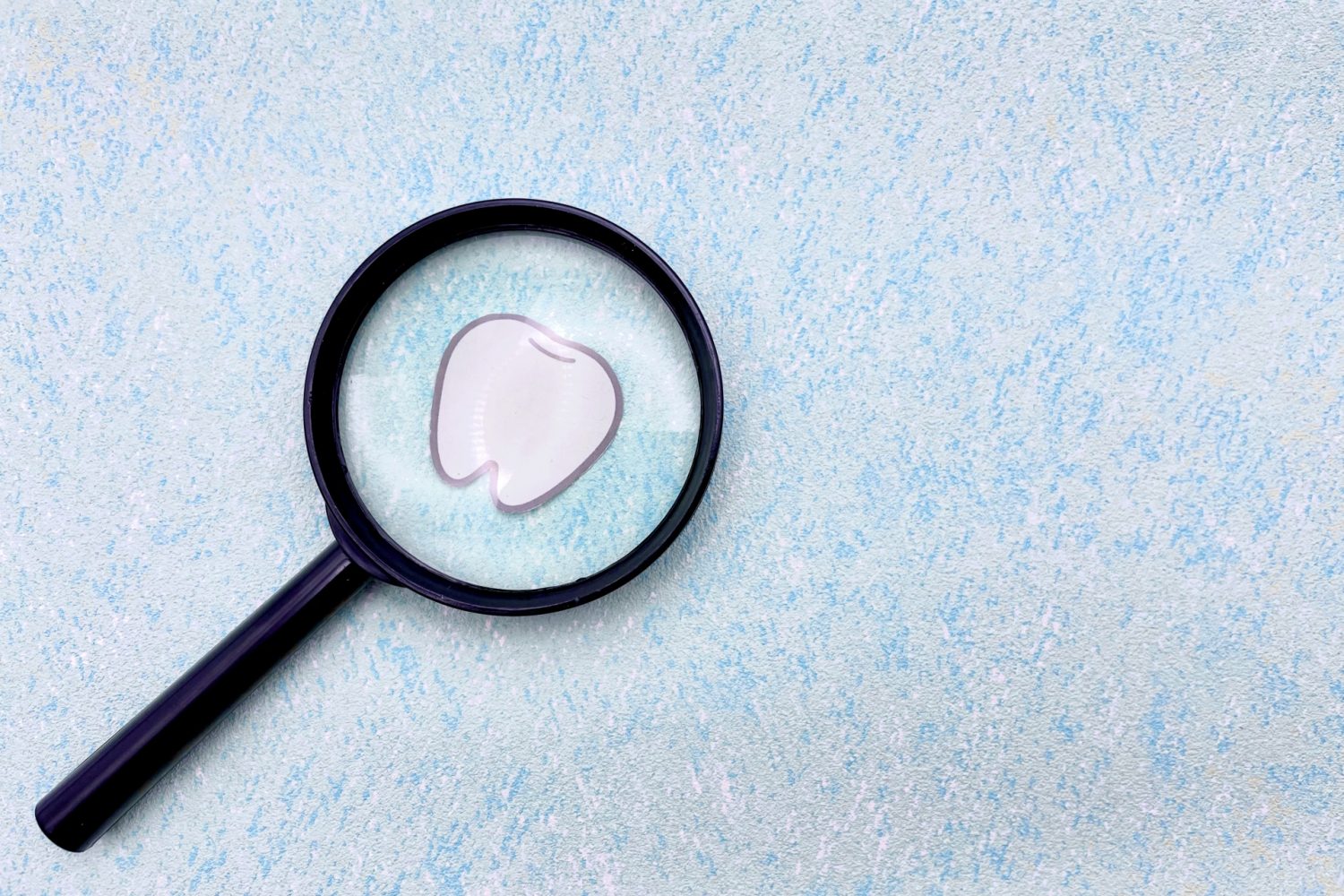 反対咬合になってしまう原因