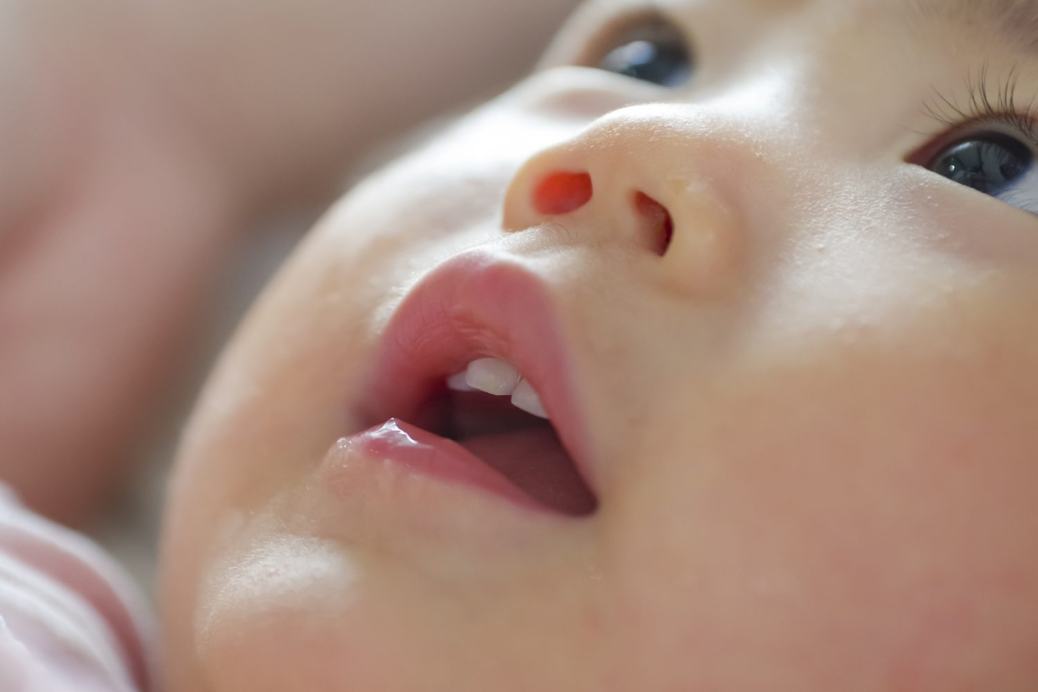 放置していると反対咬合を悪化させる原因になる癖