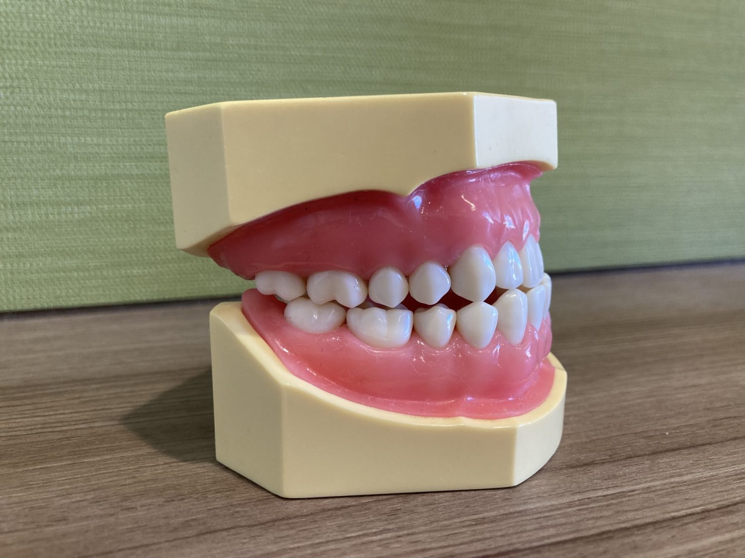 反対咬合は放置しないで！悪化する原因や将来的なリスク、治療方法も解説