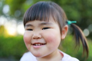 受け口を放置すると悪化する？反対咬合の原因やリスク、治療法も解説