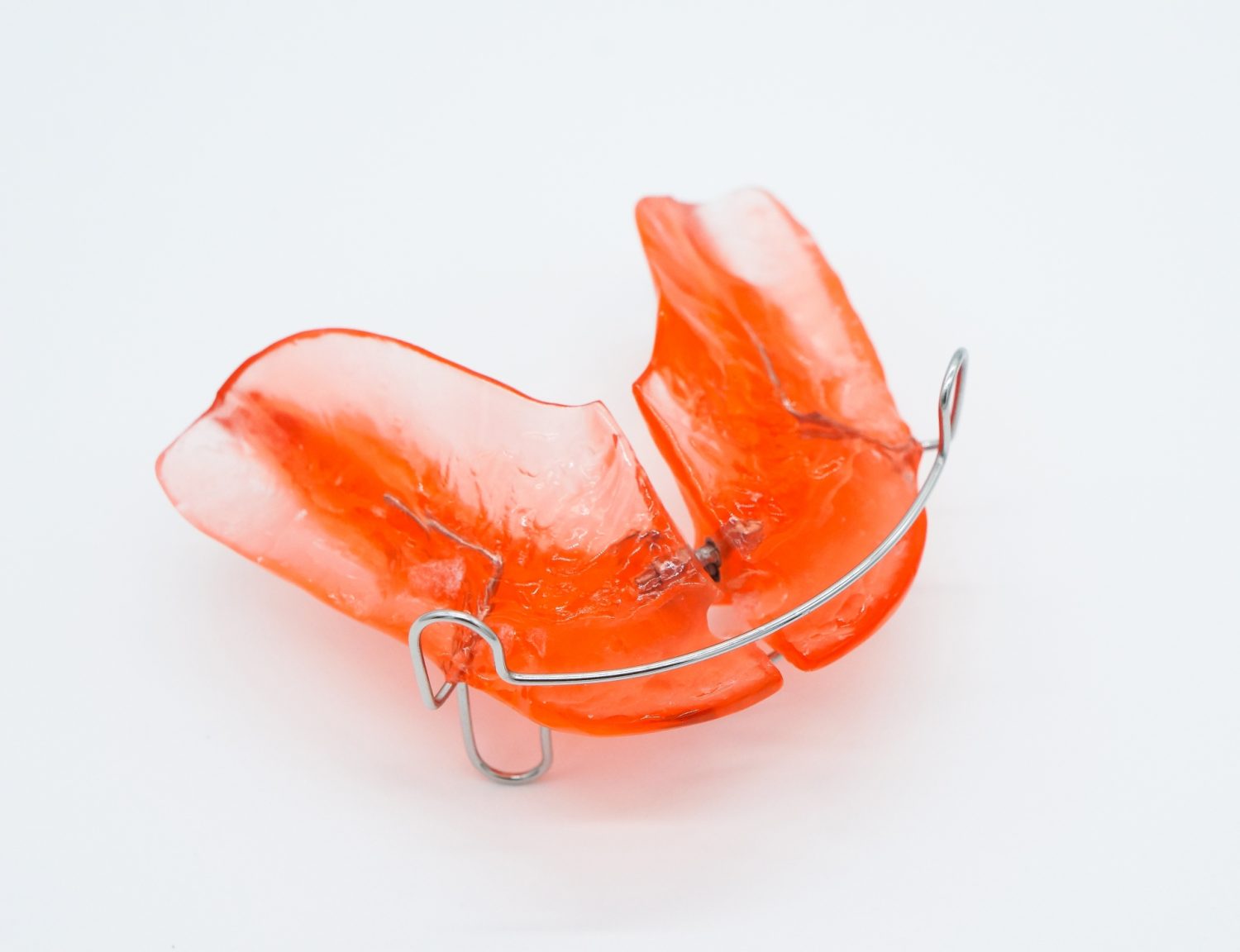 子どもの成長期に合わせた受け口の治療法