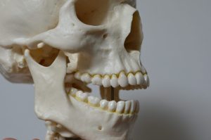 外科的矯正治療とは？適応や治療の流れ・種類を解説