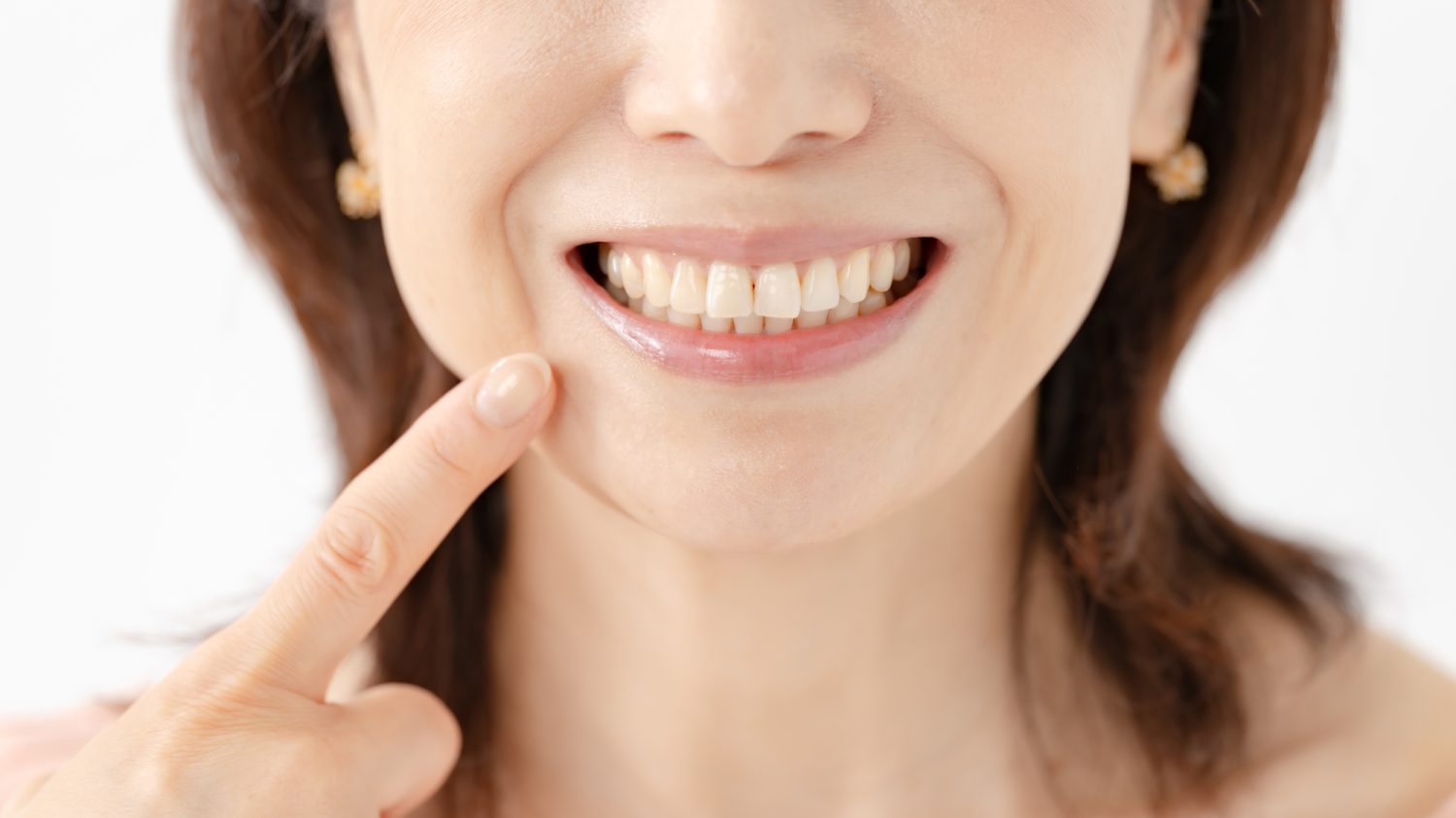 インプラント治療前のステップ：徹底した歯周病治療の重要性