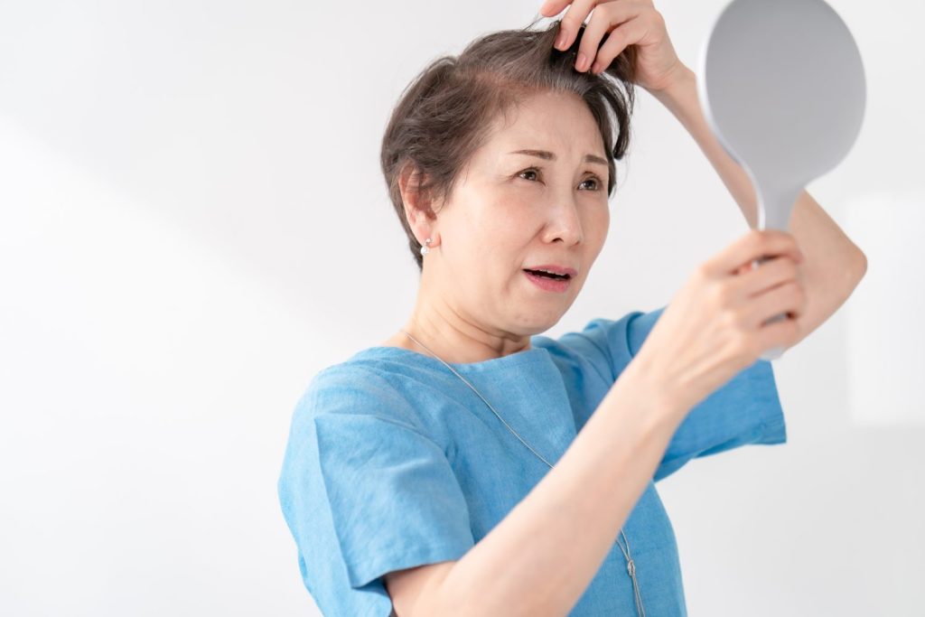 女性の「薄毛治療」を医師が解説 男性のAGAと違うの？ 植毛も男性だけのものではない
