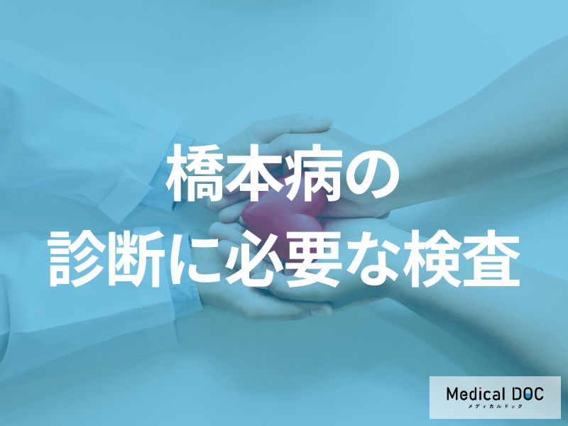 橋本病の診断基準と鑑別診断