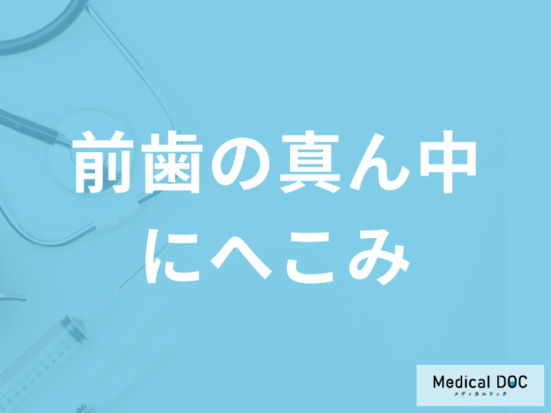 気付かないうちに「前歯の真ん中にへこみ」が…？原因と治療法を解説！
