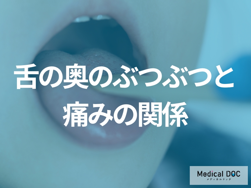 やけど?感染症?「舌の奥にぶつぶつ」ができるのは?痛みあり・なし別に歯科医師が解説!