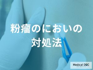 粉瘤のにおいを気にしすぎないために：清潔を保つポイントと手術相談のすすめ