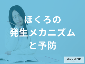 ほくろの発生メカニズムと予防