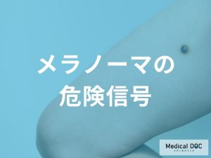 メラノーマの色や形に現れる危険信号「出血」や「ただれ」は進行のサインかも。