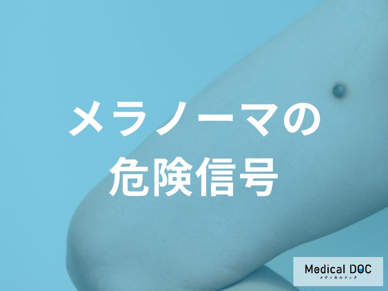 メラノーマの色や形に現れる危険信号「出血」や「ただれ」は進行のサインかも。