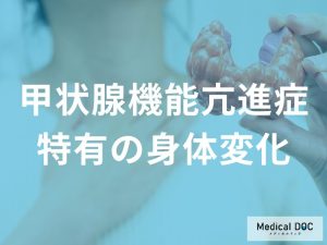 甲状腺機能亢進症に特有の身体変化