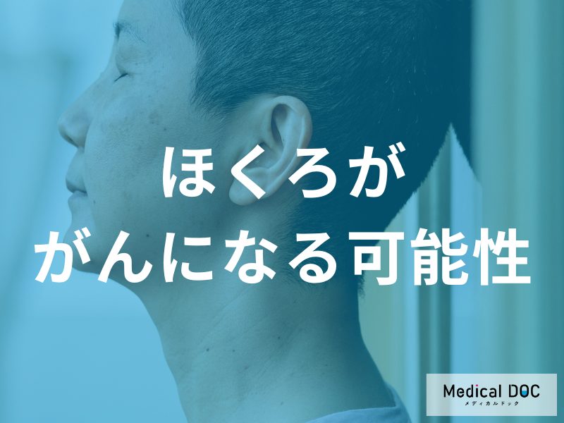 ほくろががんになる可能性