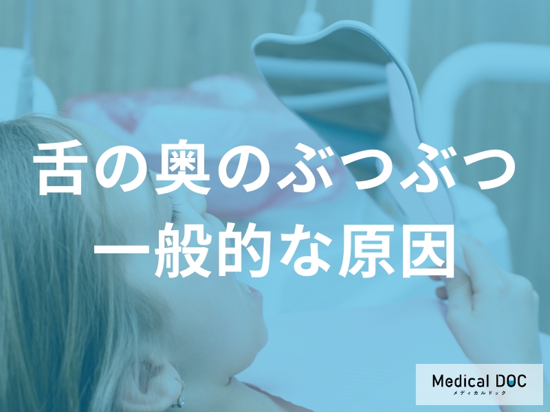 「舌の奥にぶつぶつ」は”性感染症”のサイン?何科に受診すれば良いかも歯科医師が解説!