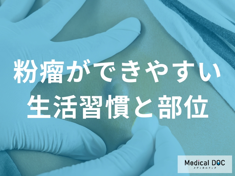 粉瘤の原因は摩擦だった?できやすい部位と日常生活で気をつけたいこと