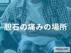 胆石の痛みが出現する場所