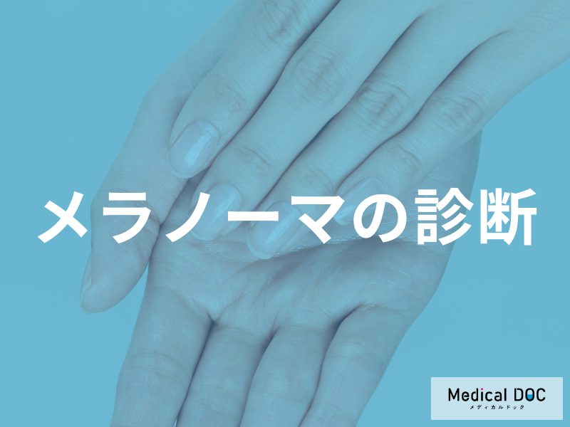 日本人は足の裏や爪に多い！増加傾向のメラノーマの特徴と、確定診断までの流れ