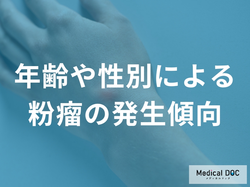 粉瘤はなぜ男性に多い?20代〜40代に多く見られる発症傾向を医師が解説
