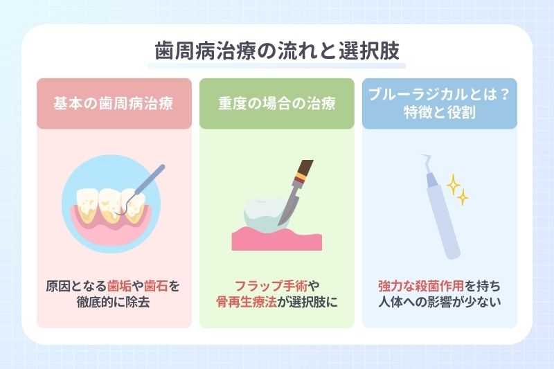 歯周病治療の流れと選択肢