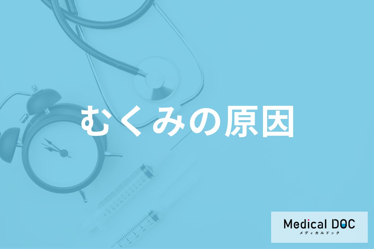 「むくみ」の原因はご存じですか? なぜ手足や体がむくんでしまうのか医師が解説!