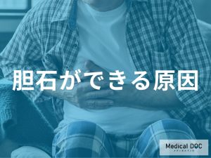 胆石ができる主な原因
